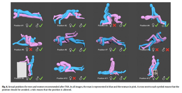 Sexual Activity After a Total Hip Replacement